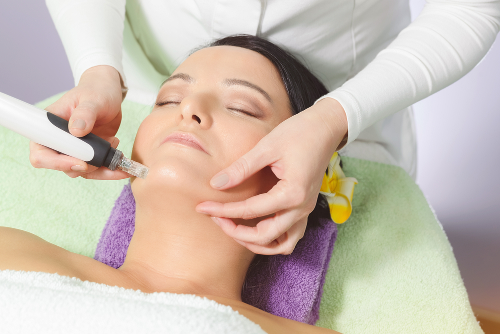 Microneedling