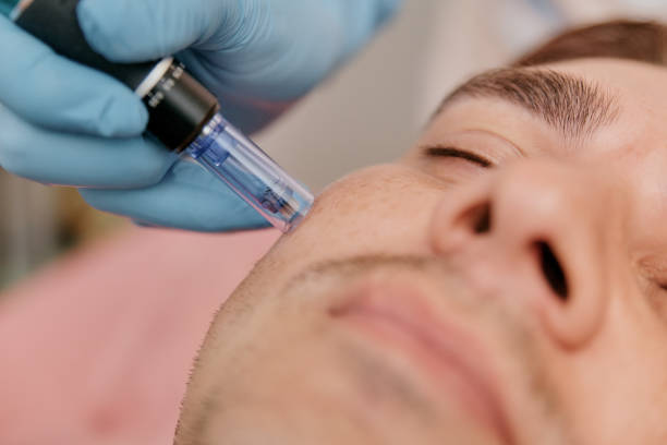 Exosome Skin Booster